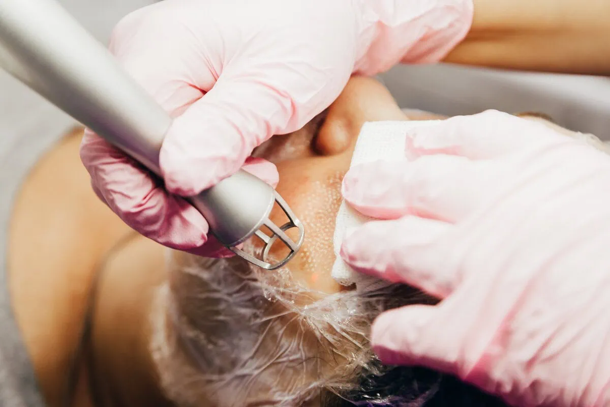 Request your fractional laser treatment