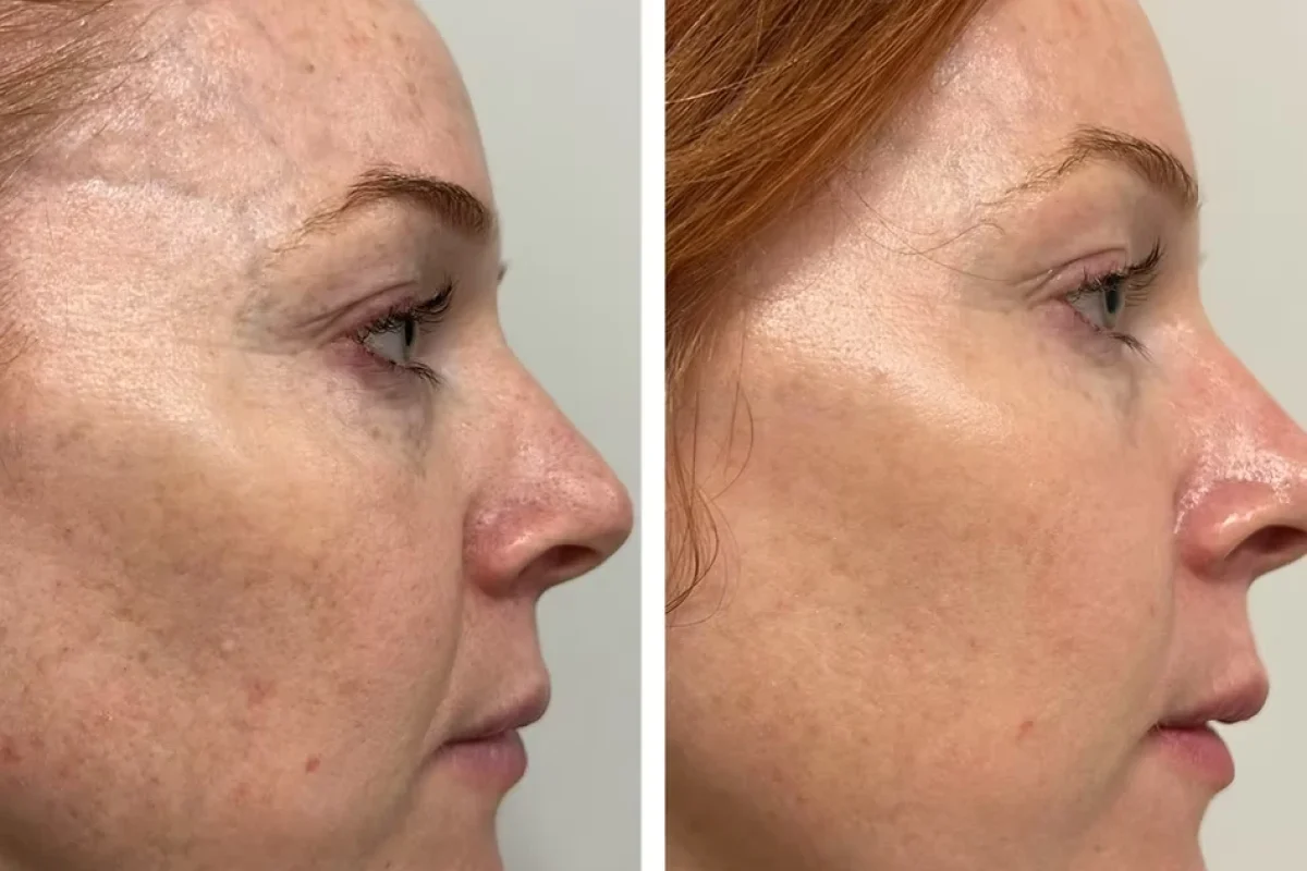 Before and After Image