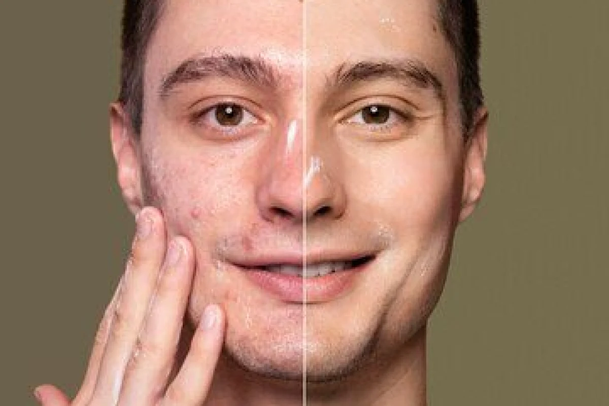 Before and After Image