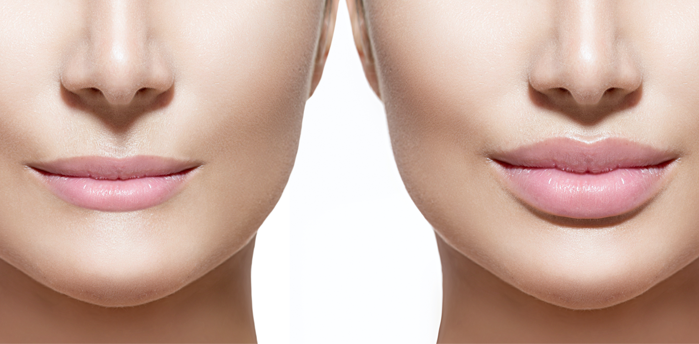 Cosmetic Fillers Florida, Cosmetic Injectables Orlando, NaturalFill FL,  Liquid Facelift Melbourne